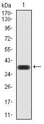 Anti-KDM1B Antibody (3V868)