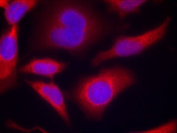 Anti-Phospho-AMPK α1 (Ser496) Polyclonal Antibody 2