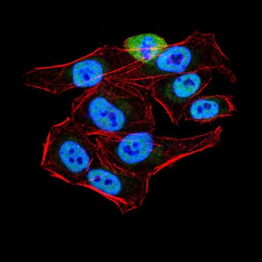 Anti-KDM1B Antibody (3V868)