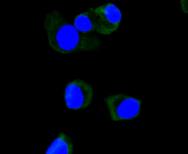 Anti-Apolipo A-I/APOA1 Antibody (2Q549)