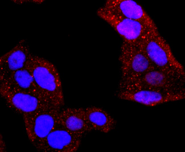Anti-Aquaporin-1/AQP1 Antibody (3P252)
