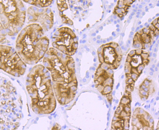 Anti-Aquaporin-1/AQP1 Antibody (3P252)