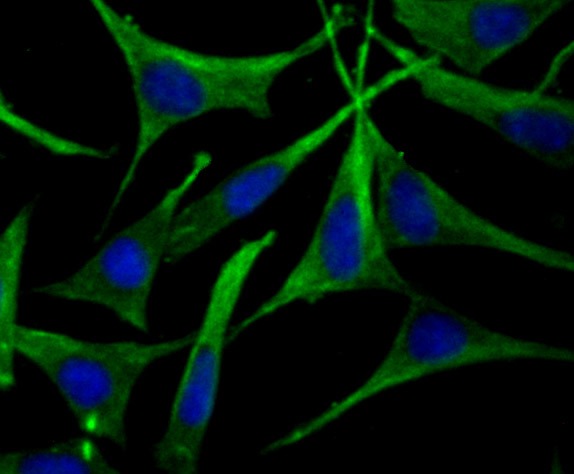 Anti-Apolipoprotein A-II/APOA2 Antibody (7V111)