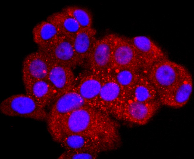 Anti-Aquaporin-1/AQP1 Antibody (3P252)