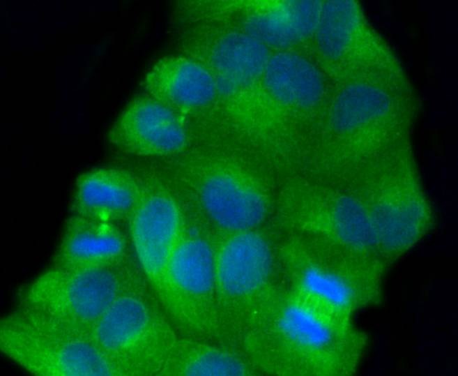 Anti-TUBB Antibody (7E2)