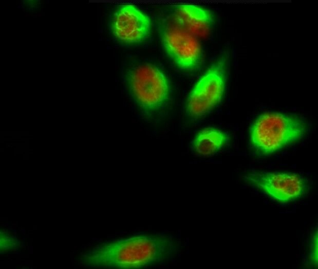 Anti-BCL2 Antibody (4G452)