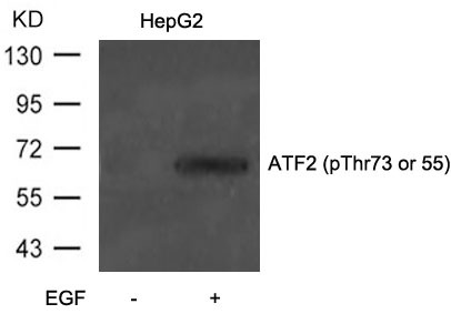 Anti-Phospho-ATF2 (Thr73 or 55) Polyclonal Antibody