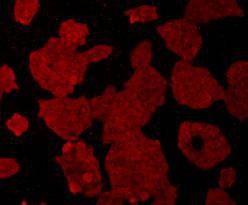 Anti-Beta-Actin Antibody (1R828)