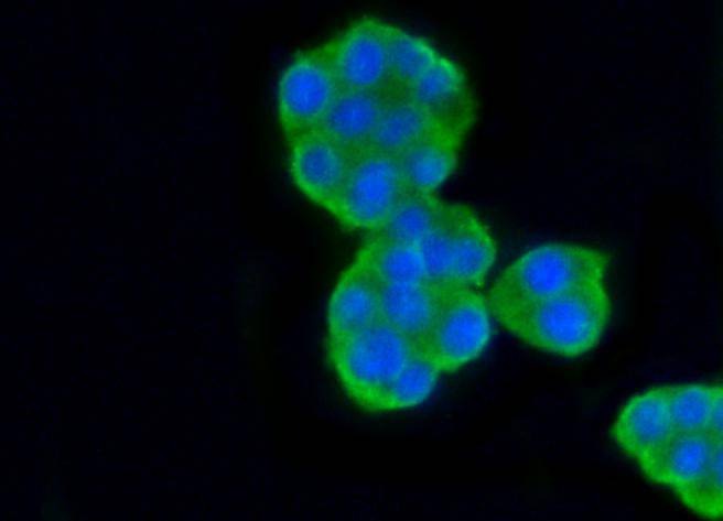 Anti-TUBB Antibody (7E2)