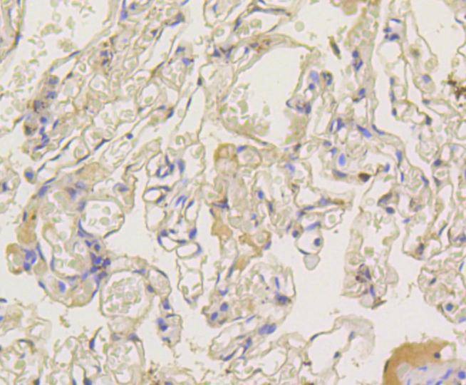 Anti-ARRB1 Antibody (3Y284)