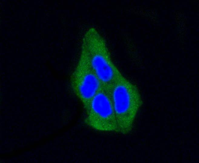 Anti-ARRB1 Antibody (3Y284)