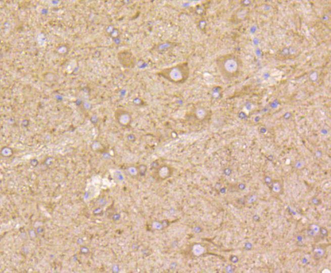 Anti-TUBB Antibody (7E2)