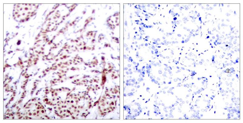 Anti-Phospho-ATF2 (Thr73 or 55) Polyclonal Antibody