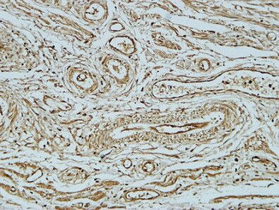Anti-BCL2 Antibody (4G452)