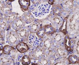 Anti-Beta-Actin Antibody (1R828)
