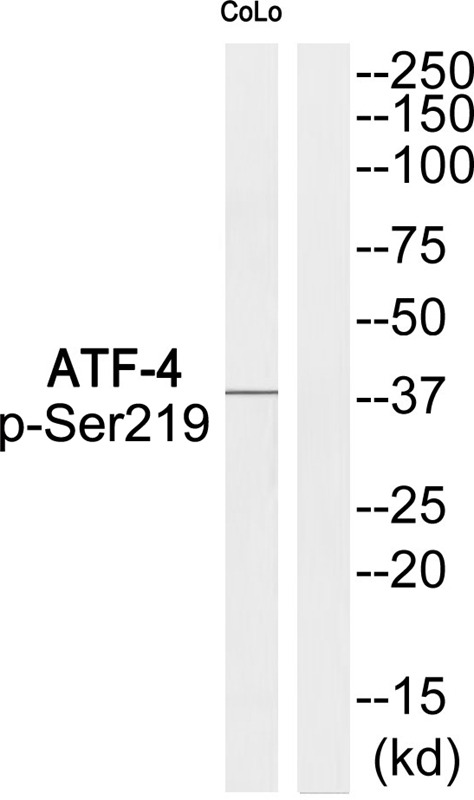 Anti-Phospho-ATF-4 (Ser219) Polyclonal Antibody 2