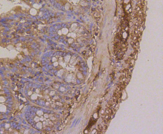 Anti-TUBB Antibody (7E2)