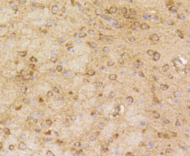 Anti-ARRB1 Antibody (3Y284)