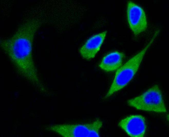 Anti-TUBB Antibody (7E2)