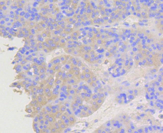 Anti-ARRB1 Antibody (3Y284)