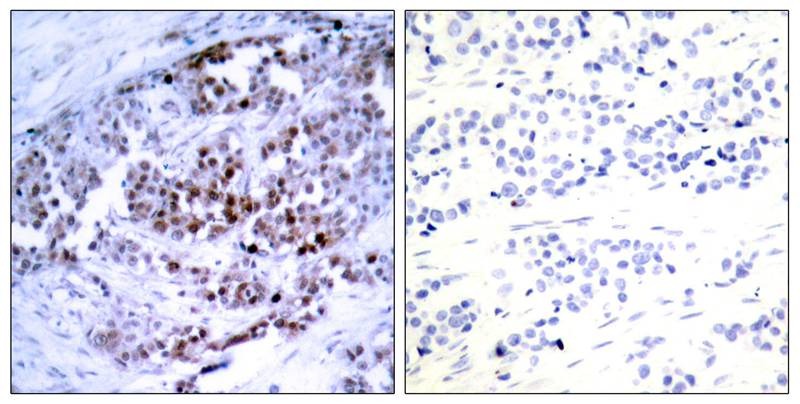 Anti-Phospho-BCL2 (Ser70) Polyclonal Antibody