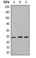Anti-Acetyl-TUBB2A (Lys379) Polyclonal Antibody