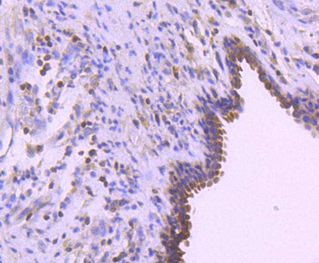 Anti-BCL2 Antibody (9S932)