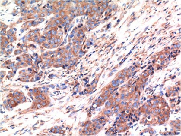 Anti-BAX Antibody (6H665)