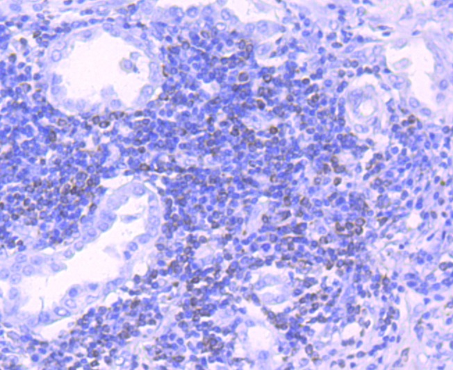 Anti-BCL2 Antibody (4Z465)