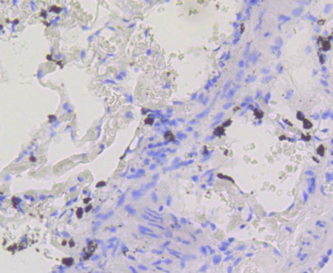 Anti-BDNF Antibody (4E523)