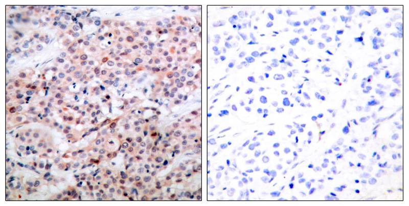 Anti-Phospho-BCL2 (Thr56) Polyclonal Antibody