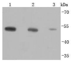 Anti-TUBB Antibody-HRP (4R941)