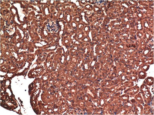 Anti-BAX Antibody (6H665)