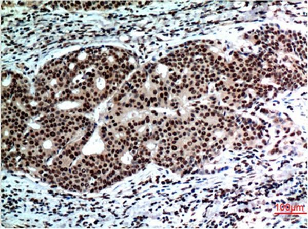 Anti-Beclin-1 Antibody (3P188)