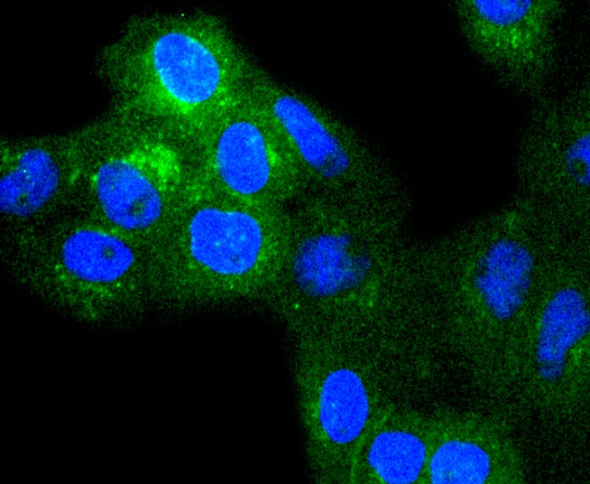 Anti-B2M/beta 2-Microglobulin Antibody (1O957)