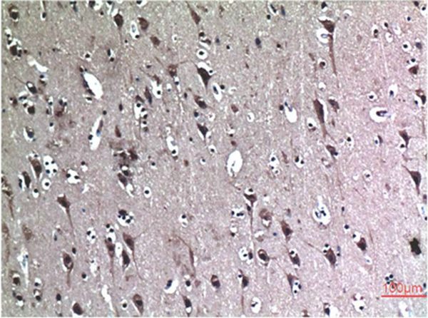 Anti-Beclin-1 Antibody (3P188)