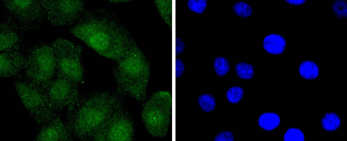 Anti-BCL2 Antibody (9S932)