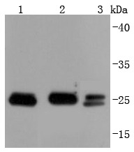 Anti-BCL2 Antibody (4Z465)