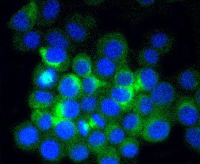 Anti-beta Ⅱ Tubulin  Antibody (5R171)