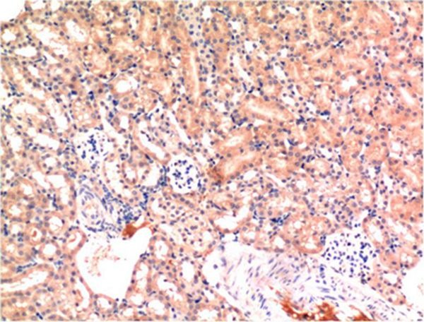 Anti-BAX Antibody (6T681)