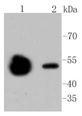 Anti-beta Ⅱ Tubulin  Antibody (5R171)