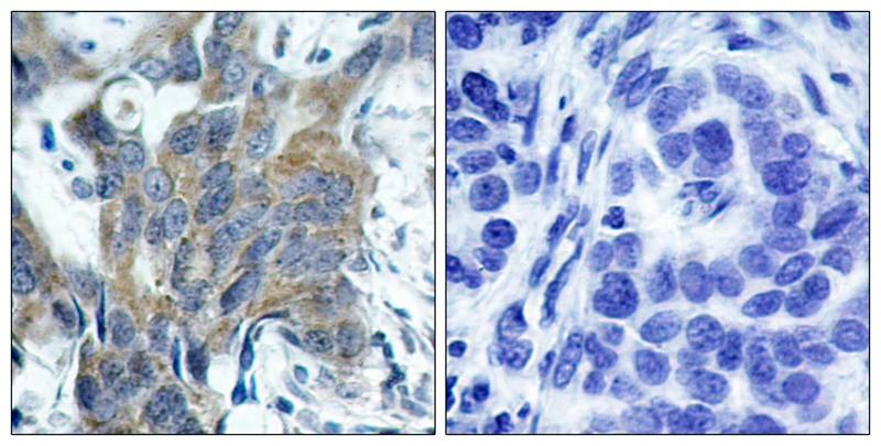 Anti-Phospho-CTNNB1 (Ser33) Polyclonal Antibody 2
