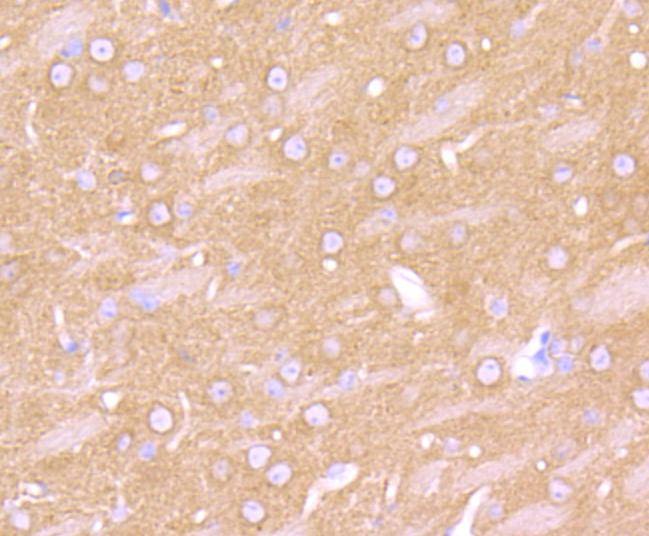 Anti-ADRB2 Antibody (3B949)