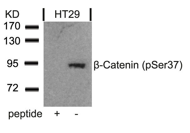 Anti-Phospho-CTNNB1 (Ser37) Polyclonal Antibody 2