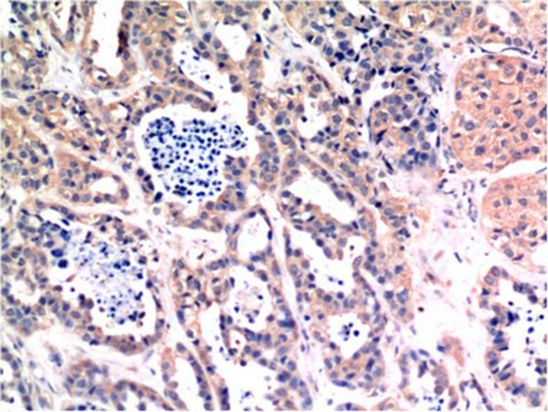 Anti-BAX Antibody (6T681)