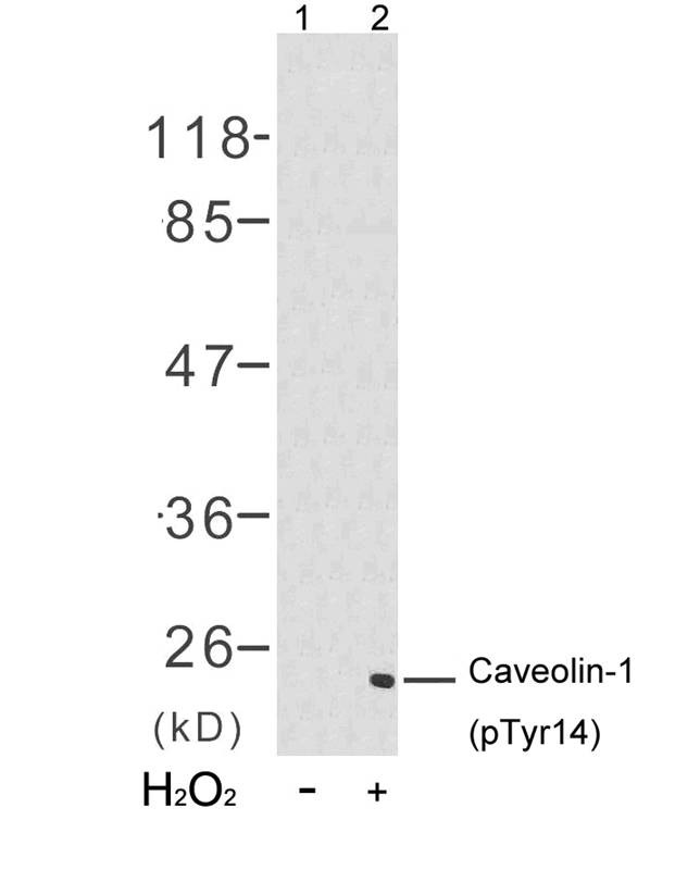 Anti-Phospho-CAV1 (Tyr14) Polyclonal Antibody