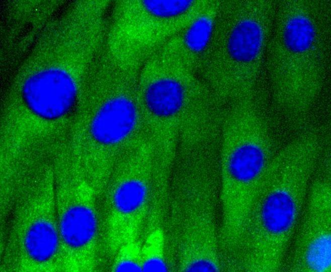 Anti-CAV1 Antibody (1U205)