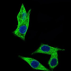 Anti-C17ORF53 Antibody (1Z939)