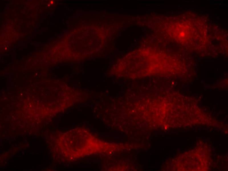 Anti-Phospho-CAV1 (Tyr14) Polyclonal Antibody