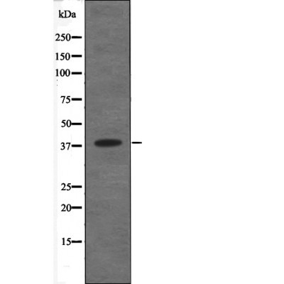 Anti-Phospho-C5AR1 (Ser334) Polyclonal Antibody